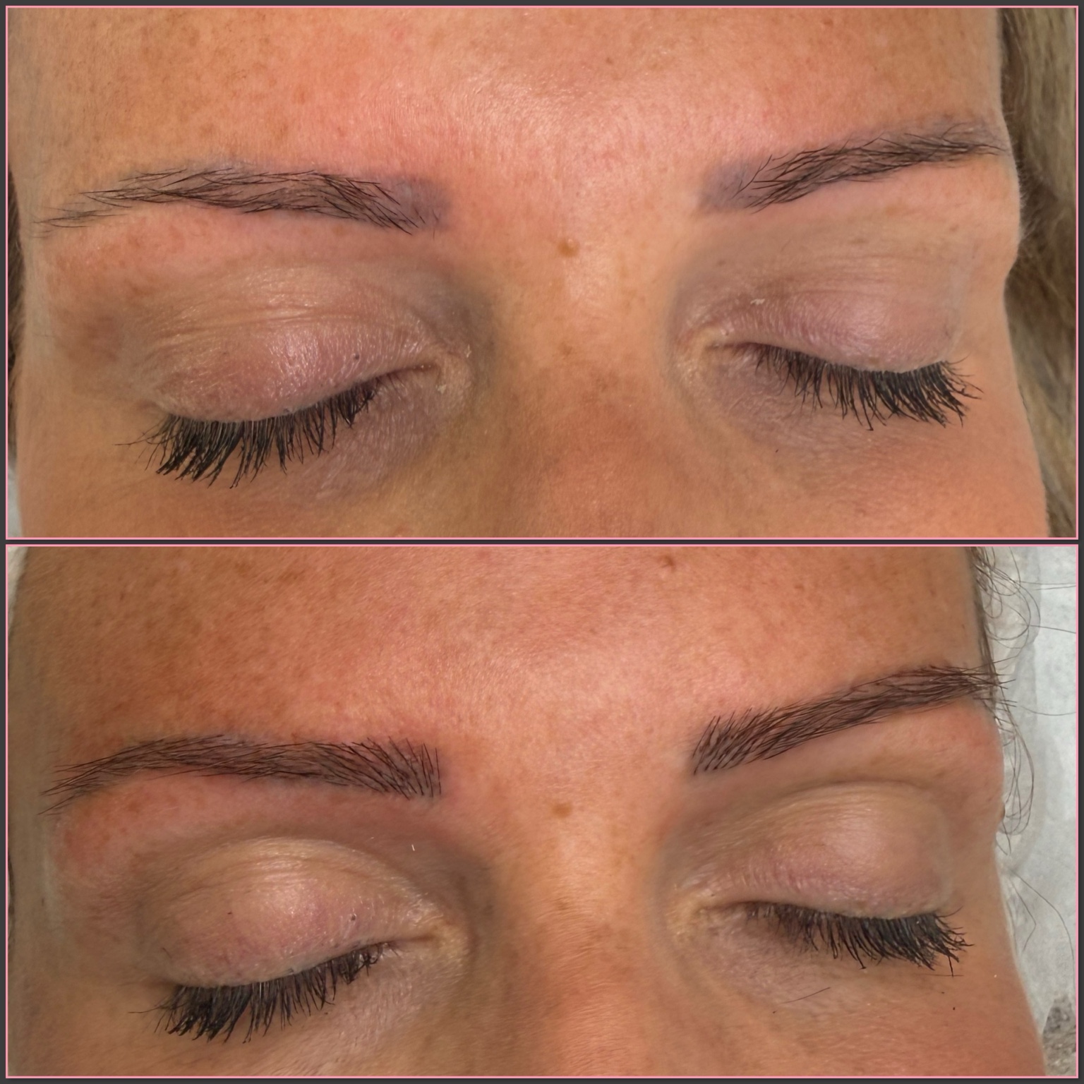 Fibre Brows gap filling before and after at Filtrr Aesthetics