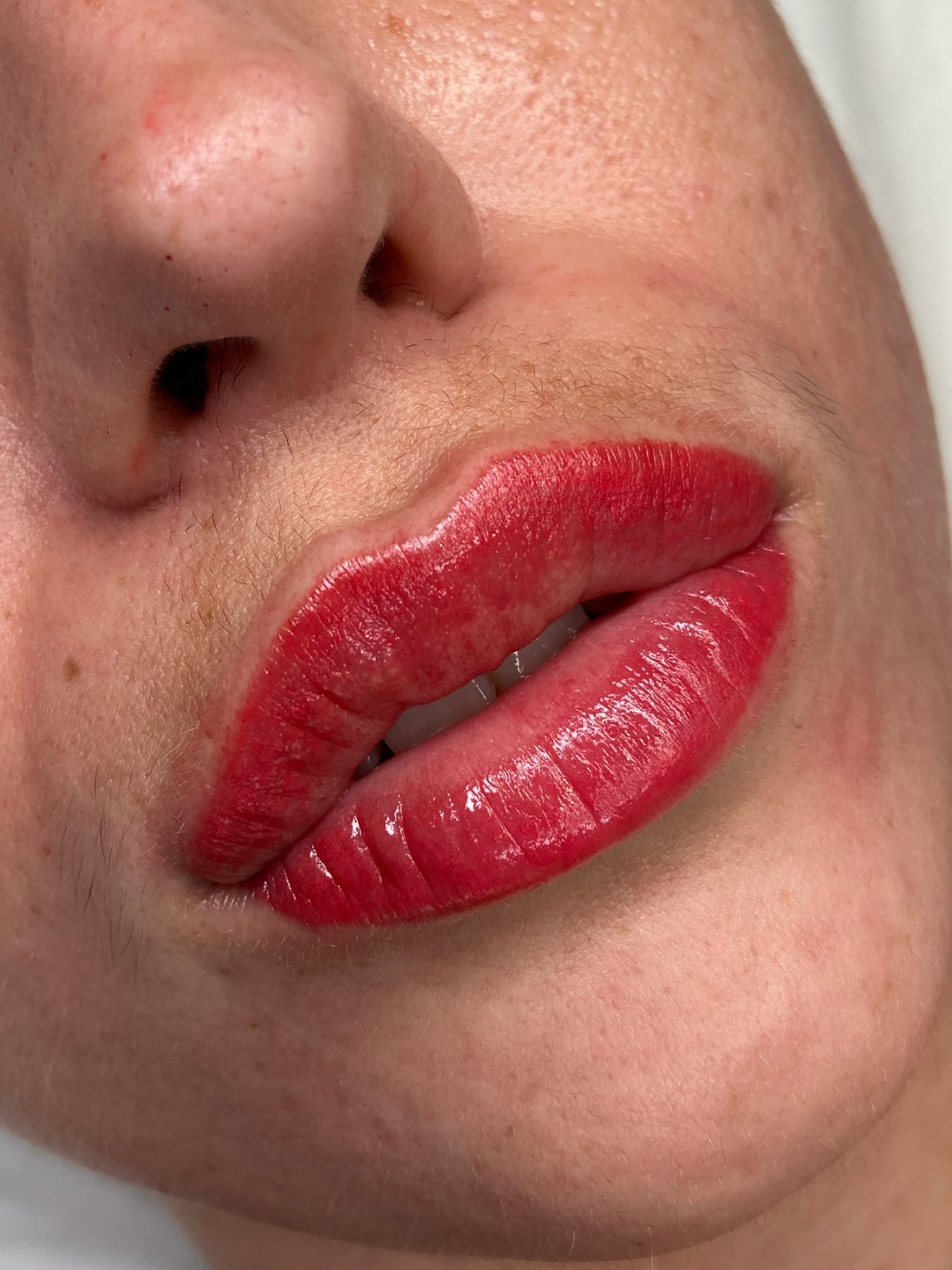 Lip blush result