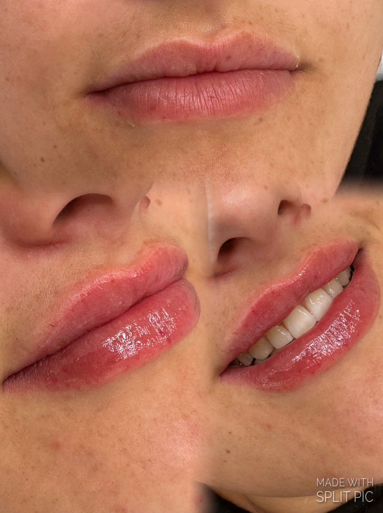 Lip blush before and after