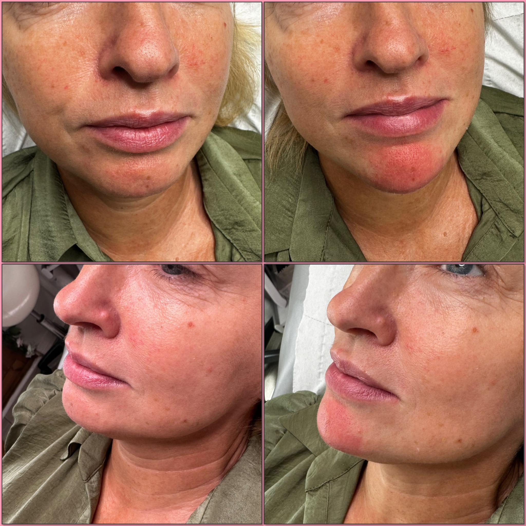 Facial skin comparison